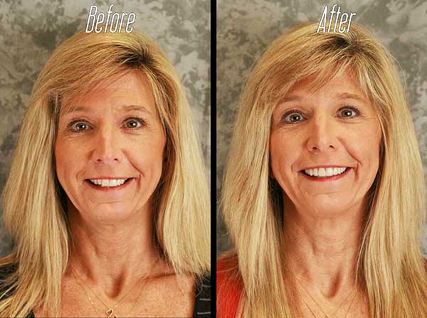 The image shows a woman with blonde hair, smiling and looking directly at the camera.