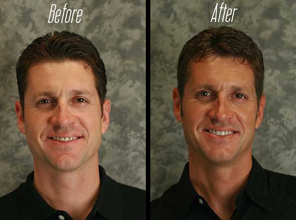 The image shows a man with two different hairstyles, one on the left and another on the right, with text overlay that reads  before  and  after.