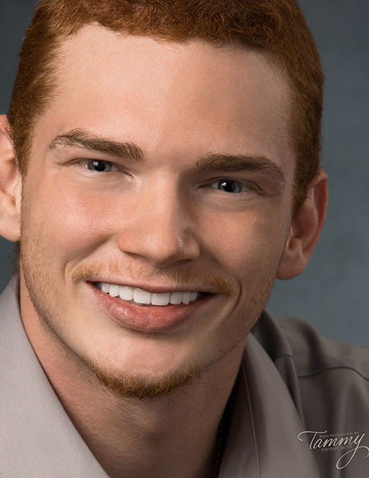 The image features a young man with red hair and a beard, smiling at the camera. He is wearing a light-colored shirt and has his teeth straightened.