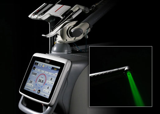 An image of a medical device with a digital display and controls, accompanied by a close-up view of the device s screen and a green laser pointer.