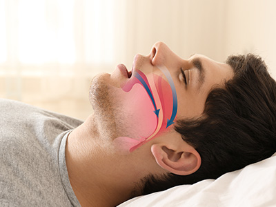 A man lying in bed with a facial mask on his eyes, nose, and mouth.