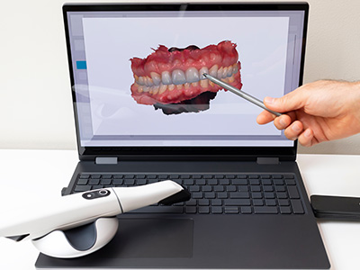 A person using a laptop with a 3D rendering of a dental implant and a 3D printing device, demonstrating the process.